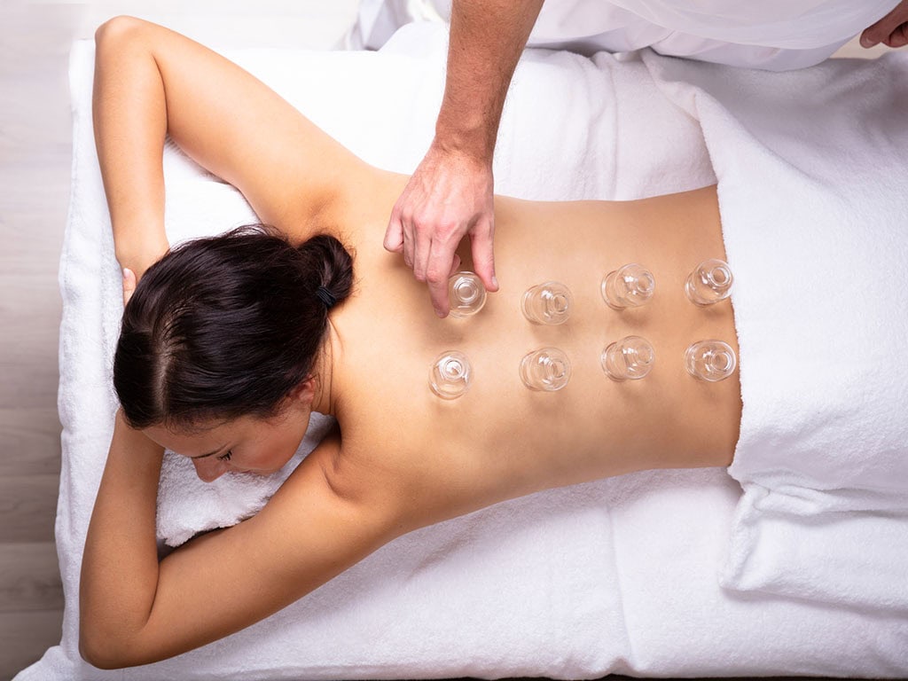 Ventosa (Cupping Therapy)